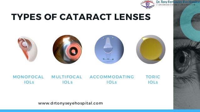 Different types of cataract lenses