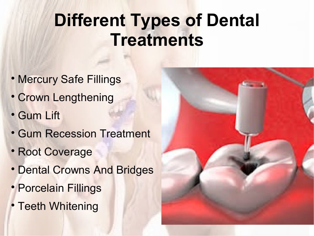 Different Types of Dental Treatments