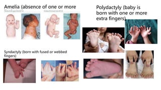 Presentation on Different Types of Disabilities.pptx