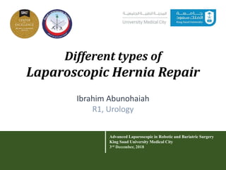 Different types of
Laparoscopic Hernia Repair
Advanced Laparoscopic in Robotic and Bariatric Surgery
King Saud University Medical City
3rd December, 2018
Ibrahim Abunohaiah
R1, Urology
 