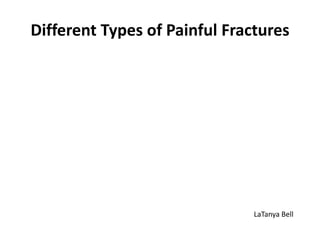 Different Types of Painful Fractures LaTanya Bell 