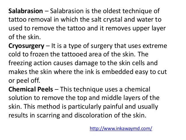 different types of tattoo removal different types of tattoo removal