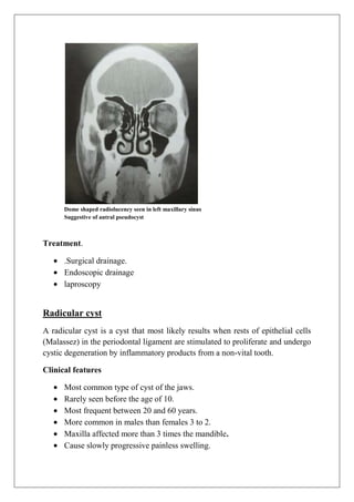 Dome shaped radiolucency seen in left maxillary sinus
Suggestive of antral pseudocyst
Treatment.
.Surgical drainage.
Endoscopic drainage
laproscopy
Radicular cyst
A radicular cyst is a cyst that most likely results when rests of epithelial cells
(Malassez) in the periodontal ligament are stimulated to proliferate and undergo
cystic degeneration by inflammatory products from a non-vital tooth.
Clinical features
Most common type of cyst of the jaws.
Rarely seen before the age of 10.
Most frequent between 20 and 60 years.
More common in males than females 3 to 2.
Maxilla affected more than 3 times the mandible.
Cause slowly progressive painless swelling.
 