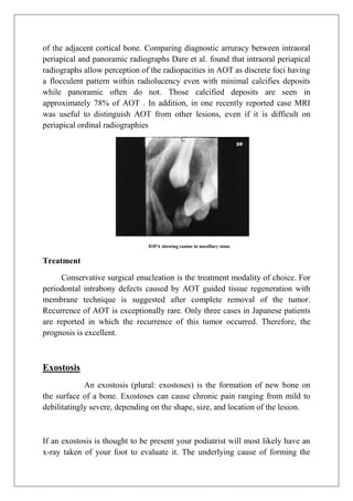 of the adjacent cortical bone. Comparing diagnostic arruracy between intraoral
periapical and panoramic radiographs Dare et al. found that intraoral periapical
radiographs allow perception of the radiopacities in AOT as discrete foci having
a flocculent pattern within radiolucency even with minimal calcifies deposits
while panoramic often do not. Those calcified deposits are seen in
approximately 78% of AOT . In addition, in one recently reported case MRI
was useful to distinguish AOT from other lesions, even if it is difficult on
periapical ordinal radiographies
IOPA showing canine in maxillary sinus
Treatment
Conservative surgical enucleation is the treatment modality of choice. For
periodontal intrabony defects caused by AOT guided tissue regeneration with
membrane technique is suggested after complete removal of the tumor.
Recurrence of AOT is exceptionally rare. Only three cases in Japanese patients
are reported in which the recurrence of this tumor occurred. Therefore, the
prognosis is excellent.
Exostosis
An exostosis (plural: exostoses) is the formation of new bone on
the surface of a bone. Exostoses can cause chronic pain ranging from mild to
debilitatingly severe, depending on the shape, size, and location of the lesion.
If an exostosis is thought to be present your podiatrist will most likely have an
x-ray taken of your foot to evaluate it. The underlying cause of forming the
 