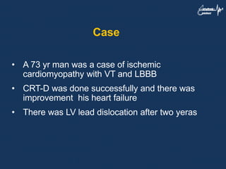 Case
• A 73 yr man was a case of ischemic
cardiomyopathy with VT and LBBB
• CRT-D was done successfully and there was
improvement his heart failure
• There was LV lead dislocation after two yeras
 