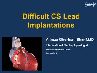Alireza Ghorbani Sharif,MD
Interventional Electrophysiologist
Tehran Arrhythmia Clinic
January 2018
Difficult CS Lead
Implantations
 