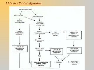 Difficult airway-assessment | PPT