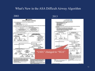 Difficult Airway Management | Jindal Chest Clinic | PPT