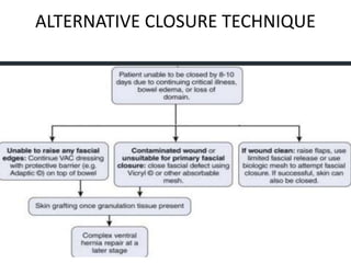 ALTERNATIVE CLOSURE TECHNIQUE
 