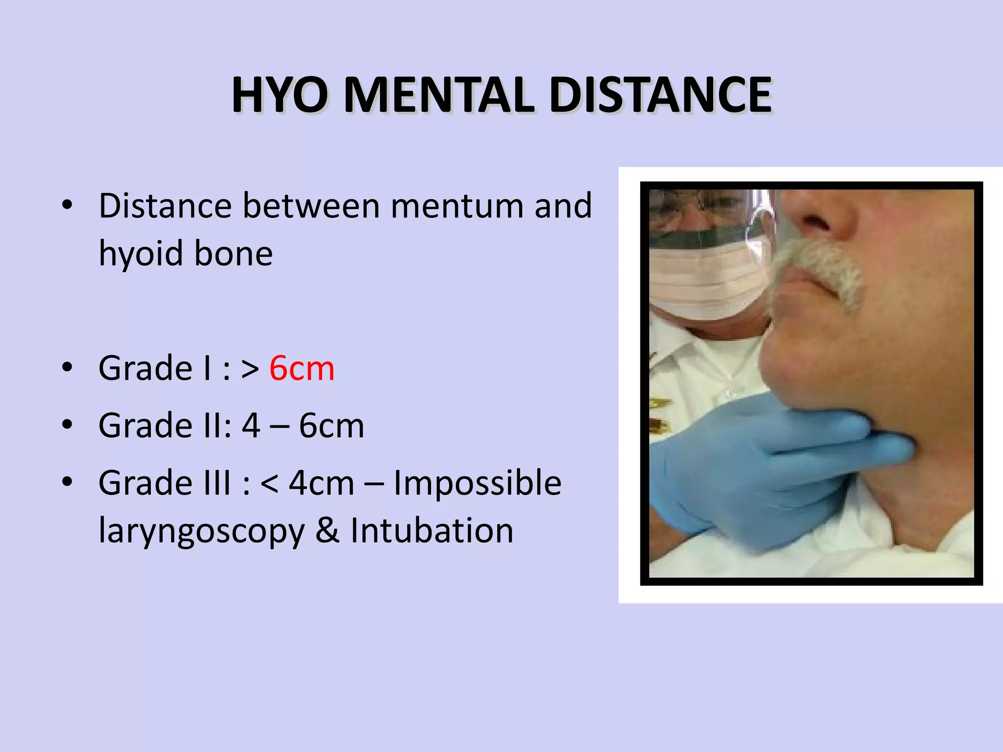HYO MENTAL DISTANCE Distance between mentum and hyoid bone Grade I :  >   6cm Grade II: 4 – 6cm Grade III :  < 4cm – Impossible laryngoscopy & Intubation 