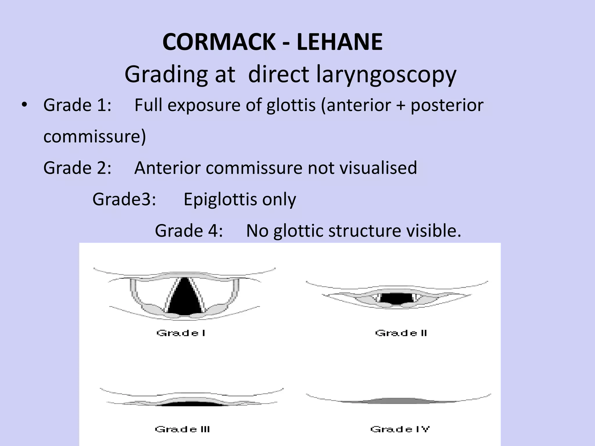 CORMACK - LEHANE    Grading at  direct laryngoscopy Grade 1:  Full exposure of glottis (anterior + posterior commissure)  Grade 2:  Anterior commissure not visualised  Grade3:  Epiglottis only  Grade 4:  No glottic structure visible. 