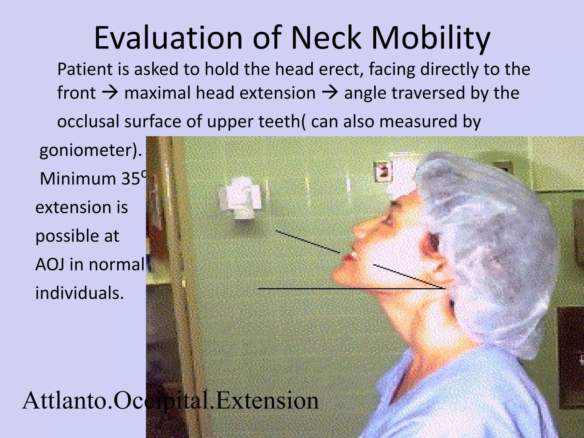 Evaluation of Neck Mobility Patient is asked to hold the head erect, facing directly to the front    maximal head extension    angle traversed by the occlusal surface of upper teeth( can also measured by goniometer). Minimum 35⁰  extension is  possible at  AOJ in normal  individuals. Attlanto.Occipital.Extension 