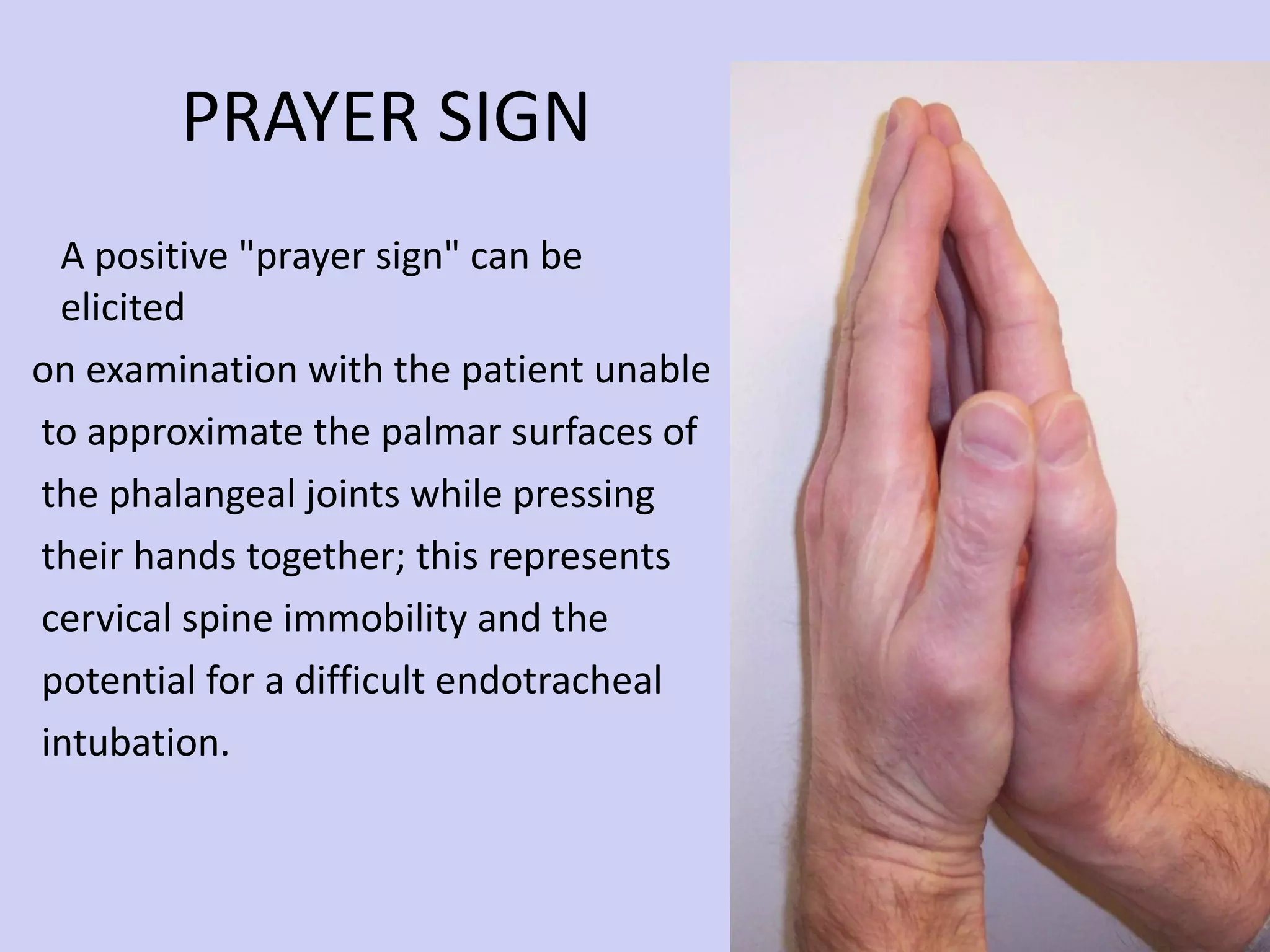 PRAYER SIGN A positive &quot;prayer sign&quot; can be elicited on examination with the patient unable to approximate the palmar surfaces of the phalangeal joints while pressing their hands together; this represents  cervical spine immobility and the  potential for a difficult endotracheal  intubation. 