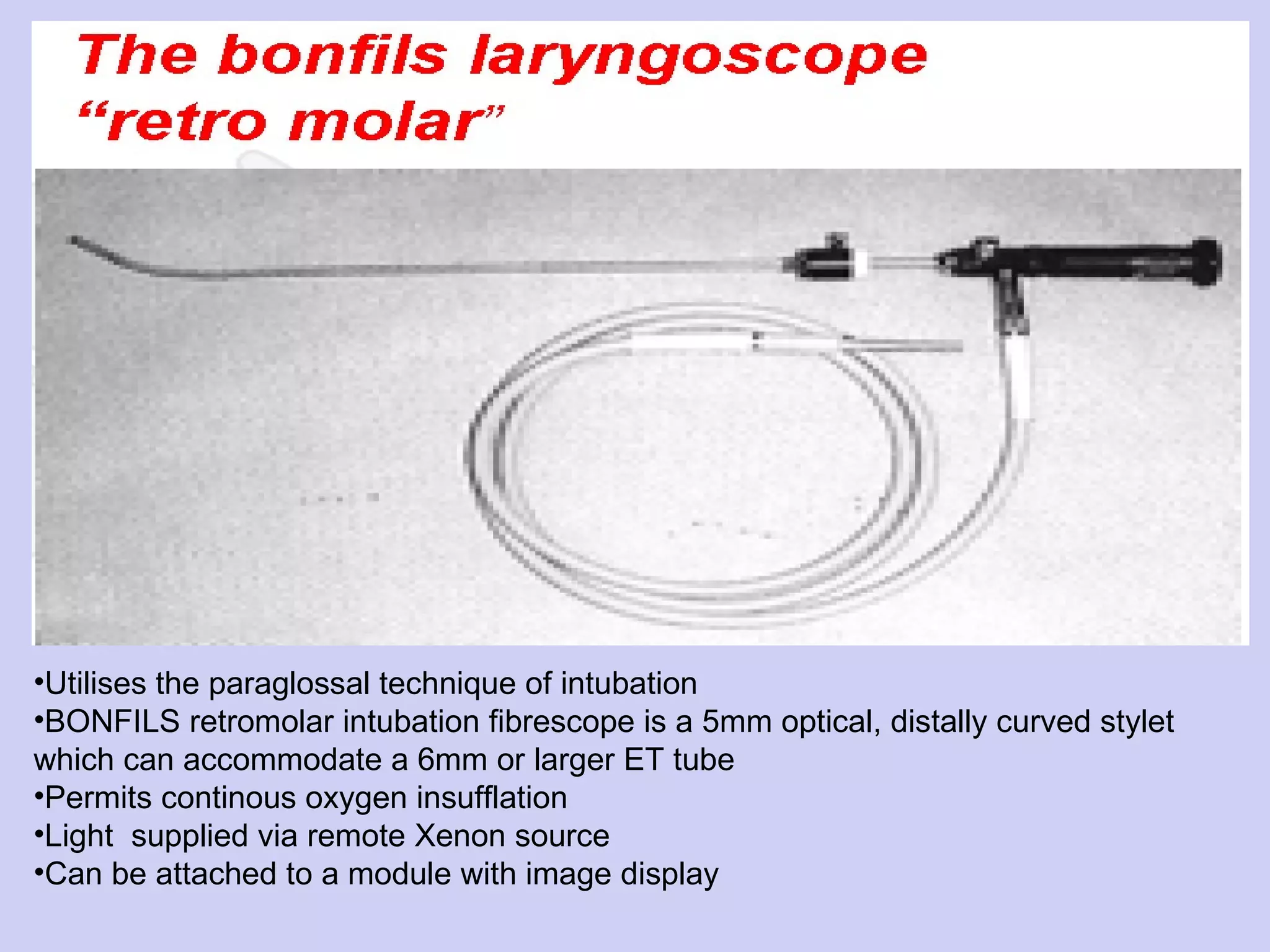 Utilises the paraglossal technique of intubation BONFILS retromolar intubation fibrescope is a 5mm optical, distally curved stylet which can accommodate a 6mm or larger ET tube Permits continous oxygen insufflation Light  supplied via remote Xenon source Can be attached to a module with image display  