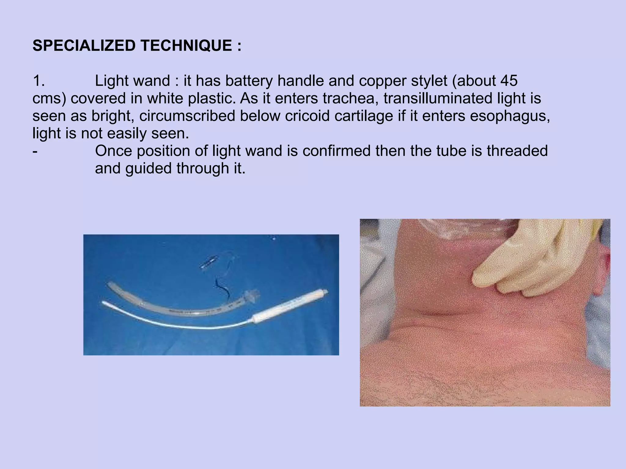 SPECIALIZED TECHNIQUE : 1. Light wand : it has battery handle and copper stylet (about 45  cms) covered in white plastic. As it enters trachea, transilluminated light is seen as bright, circumscribed below cricoid cartilage if it enters esophagus, light is not easily seen. -  Once position of light wand is confirmed then the tube is threaded  and guided through it.   