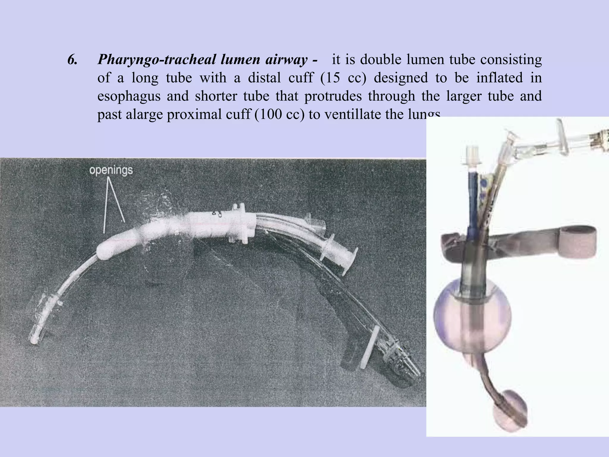 6.  Pharyngo-tracheal lumen airway -   it is double lumen tube consisting of a long tube with a distal cuff (15 cc) designed to be inflated in esophagus and shorter tube that protrudes through the larger tube and past alarge proximal cuff (100 cc) to ventillate the lungs. 