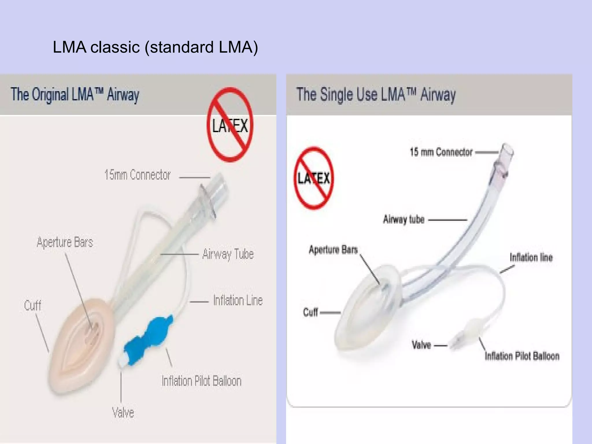 LMA classic (standard LMA) 