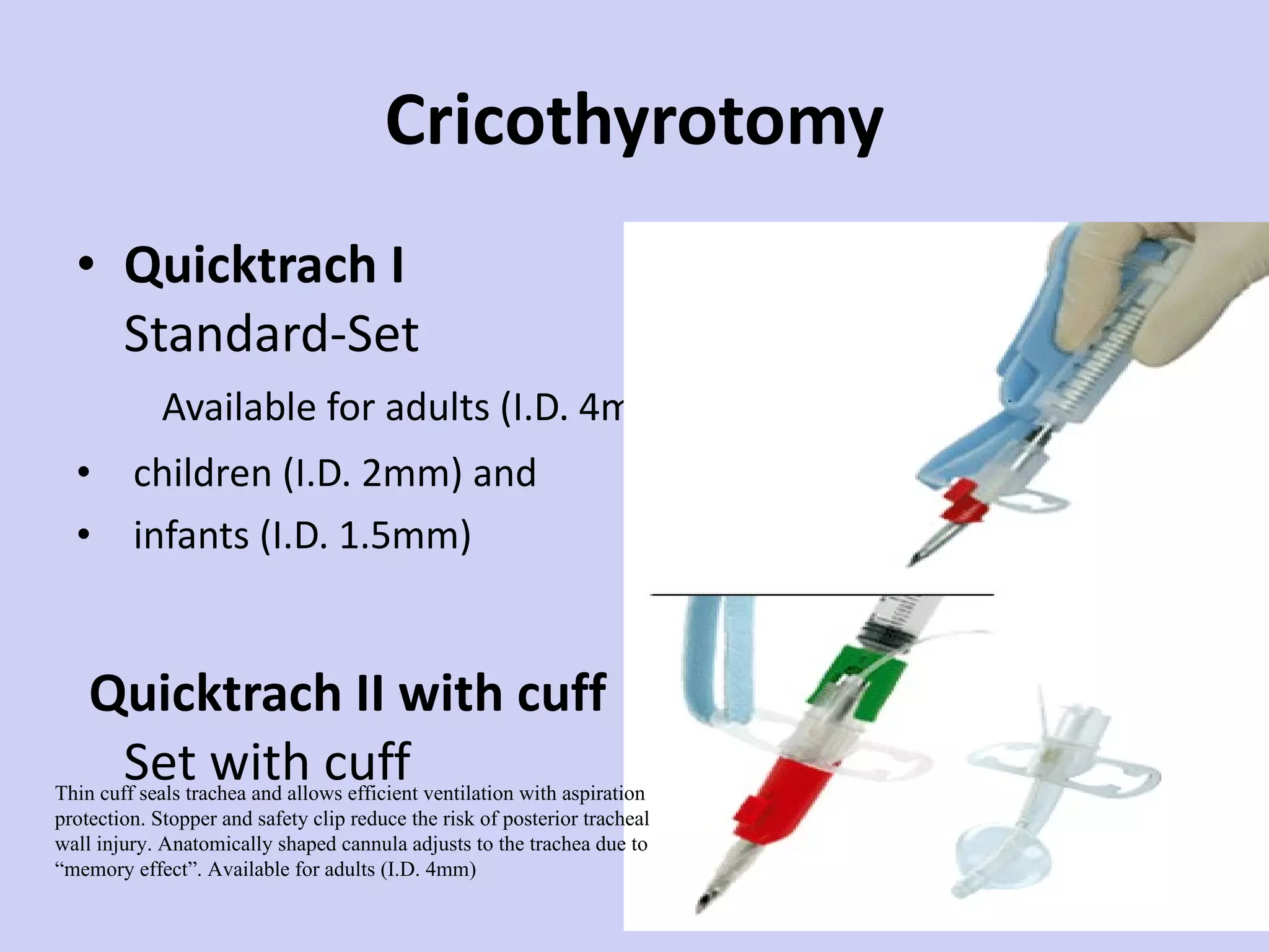 Cricothyrotomy Quicktrach I Standard-Set  Available for adults (I.D. 4mm children (I.D. 2mm) and infants (I.D. 1.5mm) Quicktrach II with cuff Set with cuff Thin cuff seals trachea and allows efficient ventilation with aspiration protection. Stopper and safety clip reduce the risk of posterior tracheal wall injury. Anatomically shaped cannula adjusts to the trachea due to “memory effect”. Available for adults (I.D. 4mm) 