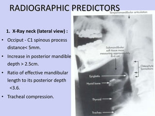 1.  X-Ray neck (lateral view) : Occiput - C1 spinous process  distance< 5mm. Increase in posterior mandible  depth > 2.5cm. Ratio of effective mandibular  length to its posterior depth  <3.6. Tracheal compression.  RADIOGRAPHIC PREDICTORS 