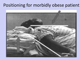 Positioning for morbidly obese patient 