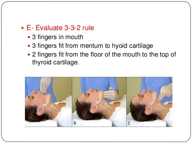 Difficult Airway