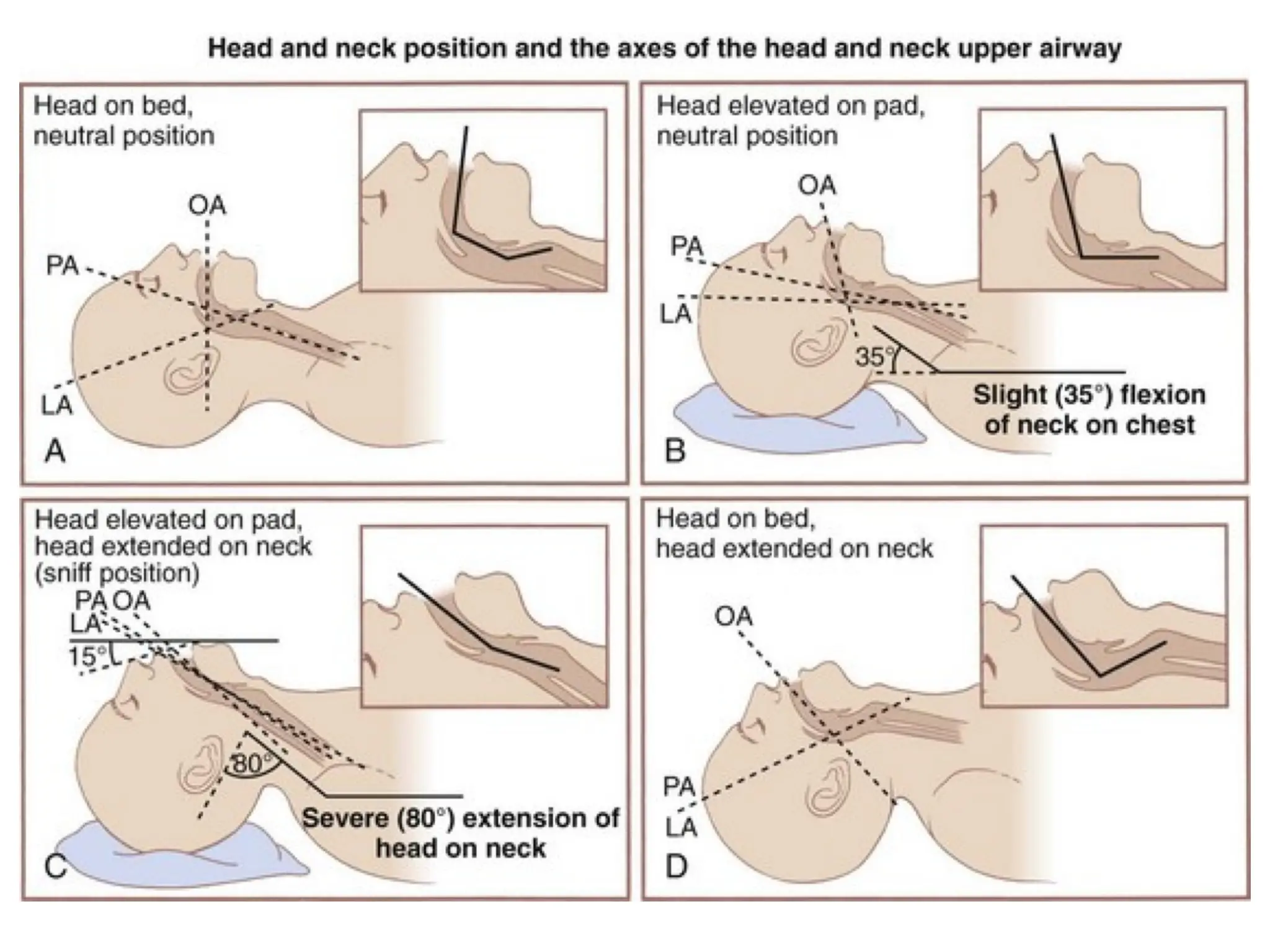 Main Airway Algorithm Difficult airway algorithm final-2.pptx,safe airway management | PPT