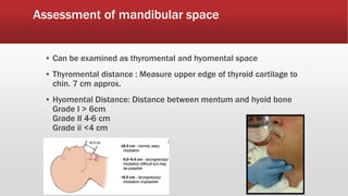 Difficult airway assessment and management by sardar saud abbas | PPTX
