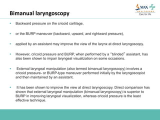 Bimanual laryngoscopy
 Backward pressure on the cricoid cartilage,
 or the BURP maneuver (backward, upward, and rightward pressure),
 applied by an assistant may improve the view of the larynx at direct laryngoscopy.
 However, cricoid pressure and BURP, when performed by a “blinded” assistant, has
also been shown to impair laryngeal visualization on some occasions.
 External laryngeal manipulation (also termed bimanual laryngoscopy) involves a
cricoid pressure- or BURP-type maneuver performed initially by the laryngoscopist
and then maintained by an assistant.
 It has been shown to improve the view at direct laryngoscopy. Direct comparison has
shown that external laryngeal manipulation (bimanual laryngoscopy) is superior to
BURP in improving laryngeal visualization, whereas cricoid pressure is the least
effective technique.
 