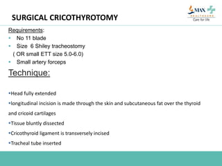 SURGICAL CRICOTHYROTOMY
Requirements:
 No 11 blade
 Size 6 Shiley tracheostomy
( OR small ETT size 5.0-6.0)
 Small artery forceps
Technique:
Head fully extended
longitudinal incision is made through the skin and subcutaneous fat over the thyroid
and cricoid cartilages
Tissue bluntly dissected
Cricothyroid ligament is transversely incised
Tracheal tube inserted
 