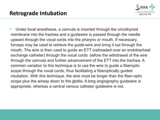 Retrograde Intubation
 Under local anesthesia, a cannula is inserted through the cricothyroid
membrane into the trachea and a guidewire is passed through the needle
upward through the vocal cords into the pharynx or mouth. If necessary,
forceps may be used to retrieve the guide-wire and bring it out through the
mouth. The wire is then used to guide an ETT (railroaded over an endotracheal
exchange catheter) through the vocal cords before the withdrawal of the wire
through the cannula and further advancement of the ETT into the trachea. A
common variation to this technique is to use the wire to guide a fiberoptic
scope through the vocal cords, thus facilitating a fiberoptically guided
intubation. With this technique, the wire must be longer than the fiber-optic
scope plus the airway down to the glottis. A long angiography guidewire is
appropriate, whereas a central venous catheter guidewire is not.
 