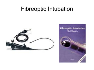 Fibreoptic Intubation
 