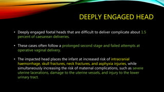 DEEPLY ENGAGED HEAD
• Deeply engaged foetal heads that are difficult to deliver complicate about 1.5
percent of caesarean deliveries.
• These cases often follow a prolonged second stage and failed attempts at
operative vaginal delivery.
• The impacted head places the infant at increased risk of intracranial
haemorrhage, skull fractures, neck fractures, and asphyxia injuries, while
simultaneously increasing the risk of maternal complications, such as severe
uterine lacerations, damage to the uterine vessels, and injury to the lower
urinary tract.
 