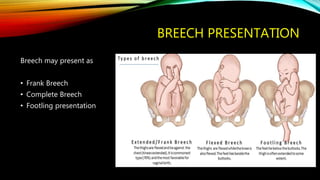 BREECH PRESENTATION
Breech may present as
• Frank Breech
• Complete Breech
• Footling presentation
 