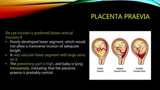 PLACENTA PRAEVIA
De Lee incision is preferred (lower vertical
incision) if
• Poorly developed lower segment, which would
not allow a transverse incision of adequate
length.
• A very vascular lower segment with large veins
on it.
• The presenting part is high, and baby is lying
transversely, indicating that the placenta
praevia is probably central.
 