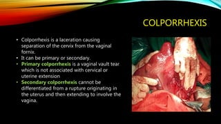COLPORRHEXIS
• Colporrhexis is a laceration causing
separation of the cervix from the vaginal
fornix.
• It can be primary or secondary.
• Primary colporrhexis is a vaginal vault tear
which is not associated with cervical or
uterine extension
• Secondary colporrhexis cannot be
differentiated from a rupture originating in
the uterus and then extending to involve the
vagina.
 