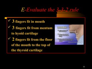 E-Evaluate the 3-3-2 rule
11
 3 fingers fit in mouth
 3 fingers fit from mentum
to hyoid cartilage
 2 fingers fit from the floor
of the mouth to the top of
the thyroid cartilage
 