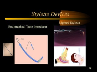 Stylette Devices
32
Lighted Stylette
Endotracheal Tube Introducer
 