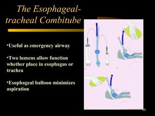 The Esophageal-
tracheal Combitube
35
•Useful as emergency airway
•Two lumens allow function
whether place in esophagus or
trachea
•Esophageal balloon minimizes
aspiration
 