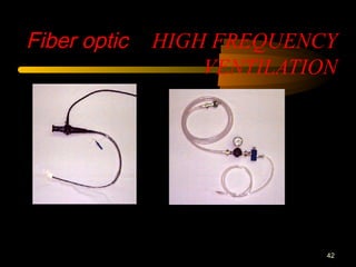 Fiber opticFiber optic HIGH FREQUENCY
VENTILATION
42
 