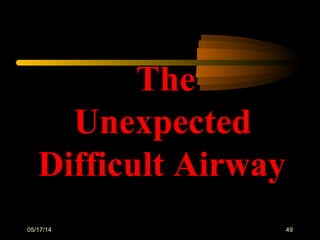 05/17/14 49
The
Unexpected
Difficult Airway
 