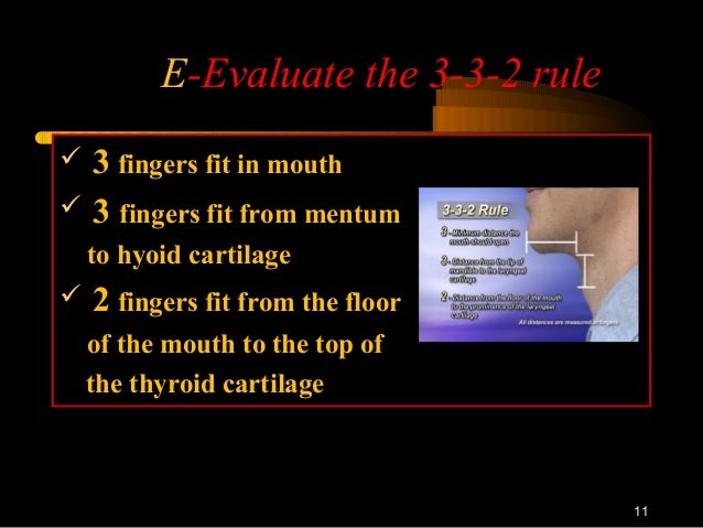Difficults Airway