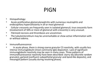 PIGN Histopathology:  Acute proliferative glomerulonephritis with numerous neutrophils and endocapillary hypercellularity in all or most glomeruli Cellular crescents are frequently seen in isolated glomeruli; true crescentic form (involvement of 50% or more of glomeruli with crescents) is very unusual. Fibrinoid necrosis and thrombosis are uncommon. The tubulointerstitium may be unremarkable or show active inflammation with or without edema. Immunofluorescence:  In acute phase, there is strong coarse granular C3 reactivity, with usually less intense immunoglobulin (most commonly IgG) deposition. Lack of significant immunoglobulin reactivity may be seen in many cases. Three patterns of immunofluorescence reactivity have been described: starry sky (discrete random granules), garland (confluent subepithelial granular and band-like deposits), and mesangial pattern (usually during resolving phase).  