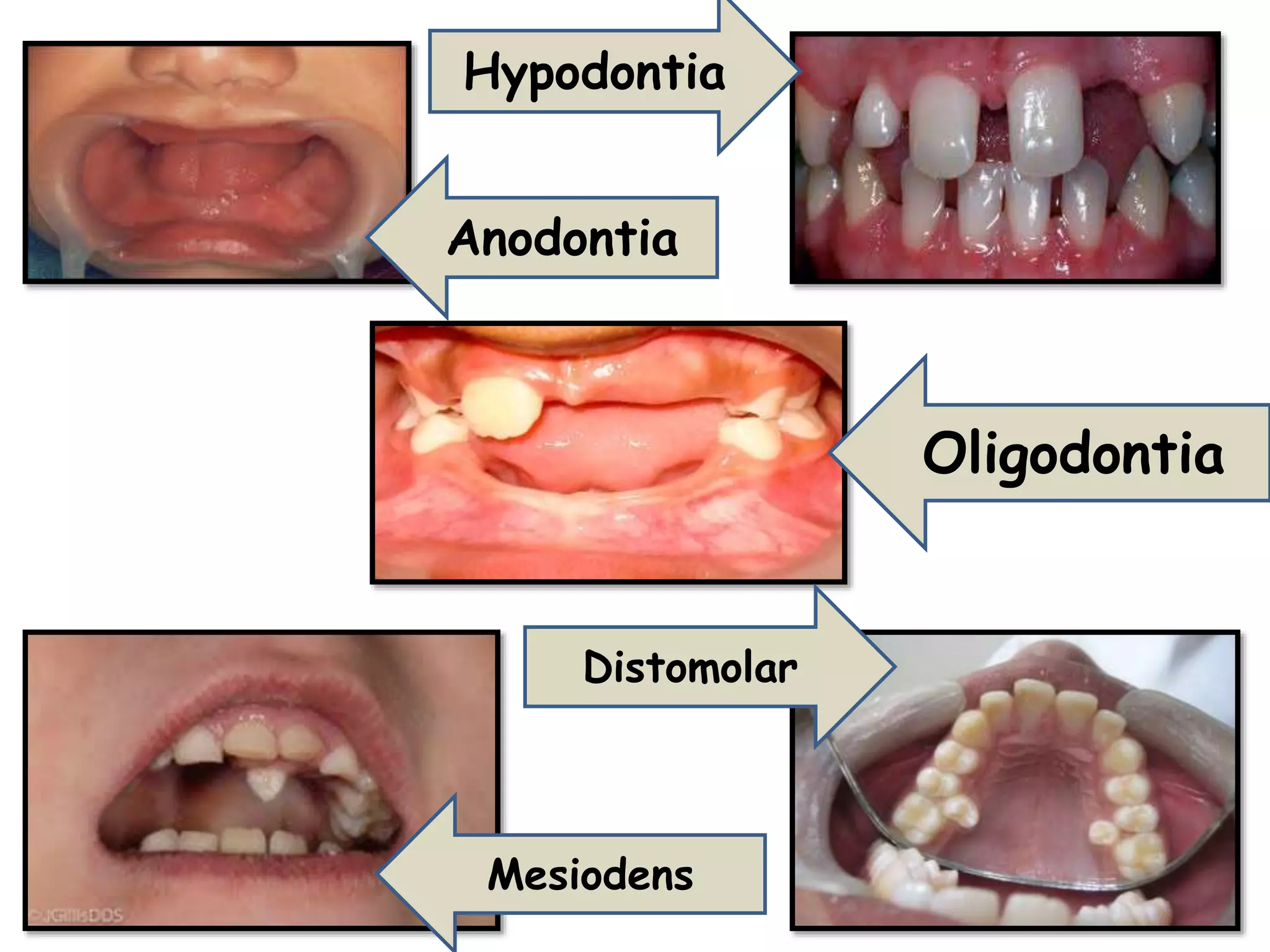 Diffrential diagnosis of common teeth complaints | PPTX