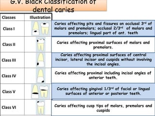 Diffrential diagnosis of common teeth complaints | PPTX