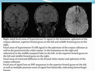 Diffuse axonal injury | PPTX