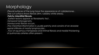 Morphology
Pleural surfaces of the lung have the appearance of cobblestones .
The cut surface shows fibrosis (firm, rubbery white areas).
Patchy interstitial fibrosis.
 Earliest lesions appear as fibroblastic foci .
Temporal heterogeneity.
Honeycomb fibrosis occurs.
The interstitial inflammation is usually patchy and consists of an alveolar
septal infiltrate of mostly lymphocytes .
 Foci of squamous metaplasia and Intimal fibrosis and medial thickening
of pulmonary arteries often present.
 