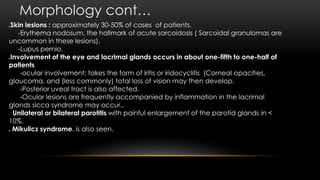 Morphology cont…
Skin lesions : approximately 30-50% of cases of patients.
-Erythema nodosum, the hallmark of acute sarcoidosis ( Sarcoidal granulomas are
uncommon in these lesions).
-Lupus pernio.
Involvement of the eye and lacrimal glands occurs in about one-fifth to one-half of
patients
-ocular involvement: takes the form of iritis or iridocyclitis (Corneal opacities,
glaucoma, and (less commonly) total loss of vision may then develop.
-Posterior uveal tract is also affected.
-Ocular lesions are frequently accompanied by inflammation in the lacrimal
glands sicca syndrome may occur..
Unilateral or bilateral parotitis with painful enlargement of the parotid glands in <
10%.
 Mikulicz syndrome, is also seen.
 