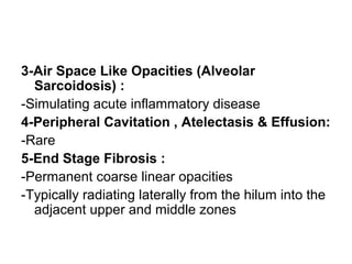 3-Air Space Like Opacities (Alveolar
Sarcoidosis) :
-Simulating acute inflammatory disease
4-Peripheral Cavitation , Atelectasis & Effusion:
-Rare
5-End Stage Fibrosis :
-Permanent coarse linear opacities
-Typically radiating laterally from the hilum into the
adjacent upper and middle zones
 