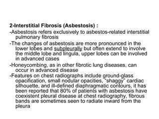 2-Interstitial Fibrosis (Asbestosis) :
-Asbestosis refers exclusively to asbestos-related interstitial
pulmonary fibrosis
-The changes of asbestosis are more pronounced in the
lower lobes and subpleurally but often extend to involve
the middle lobe and lingula, upper lobes can be involved
in advanced cases
-Honeycombing, as in other fibrotic lung diseases, can
occur in advanced disease
-Features on chest radiographs include ground-glass
opacification, small nodular opacities, “shaggy” cardiac
silhouette, and ill-defined diaphragmatic contours, it has
been reported that 80% of patients with asbestosis have
coexistent pleural disease at chest radiography, fibrous
bands are sometimes seen to radiate inward from the
pleura
 