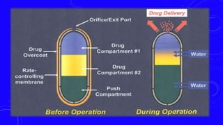 Osmotically controlled systems:-
In the osmotically controlled system, an external fluid containing a
low concentration of a drug moves across a semipermeable
membrane to a region inside the device, where the drug is in high
concentration. Osmotic pressure tends to decrease the concentration
gradient between one side of the membrane and the other. The inward
movement of fluid forces the dissolved drug out of the device
through a small orifice.
3/29/2017 22
 